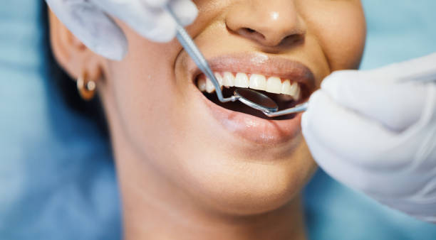 Best Urgent Care for Lost Fillings or Crowns in De Kal, TX