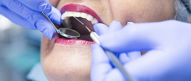 Best Emergency Treatment for Dental Infections or Abscesses in De Kal, TX